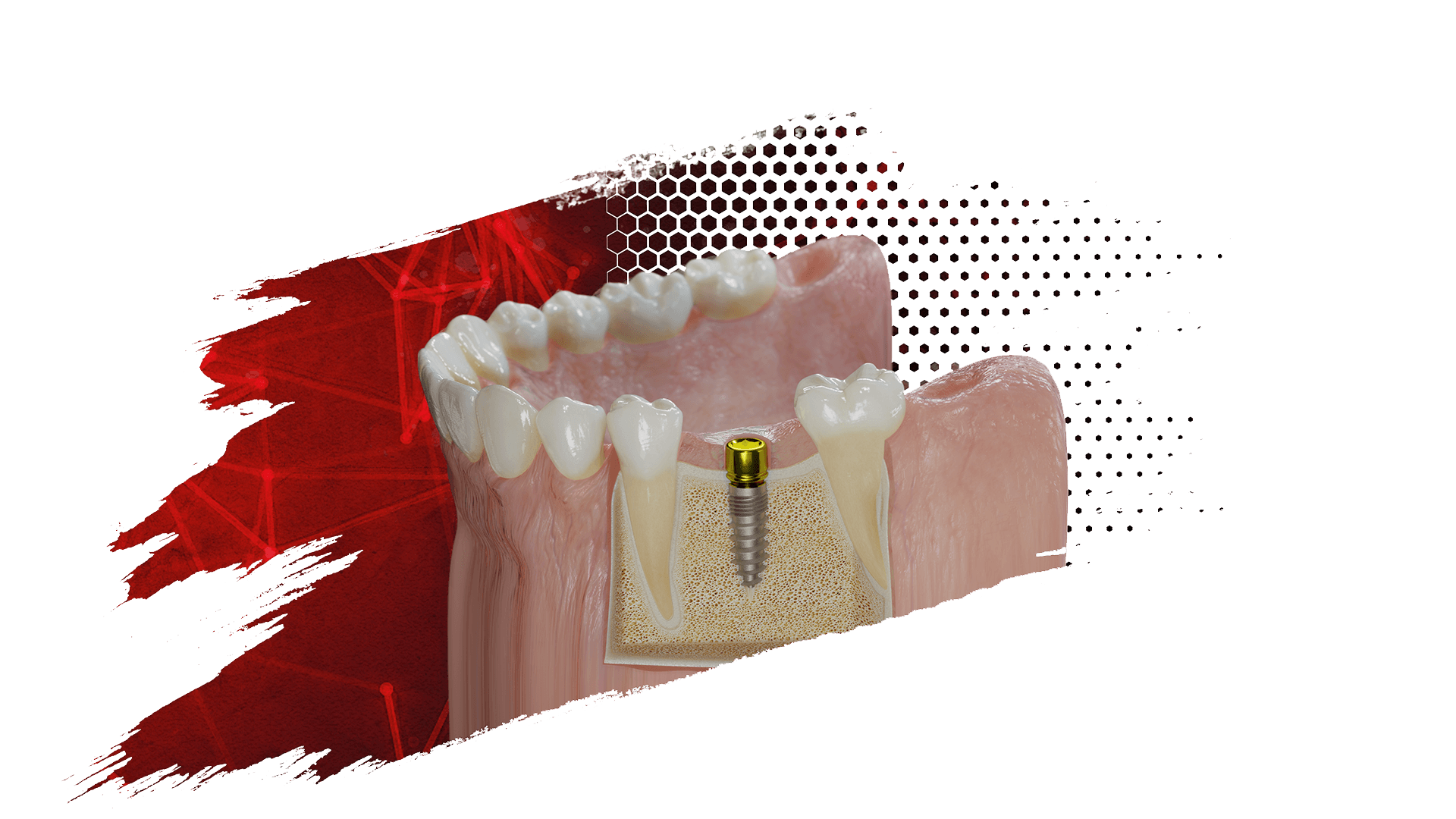 Das Champions (R)Evolution