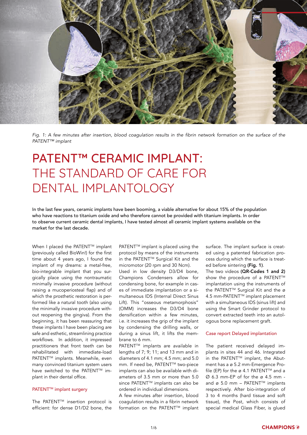 Patent Ceramic Implant:
The Standard of Care for Dental Implantology