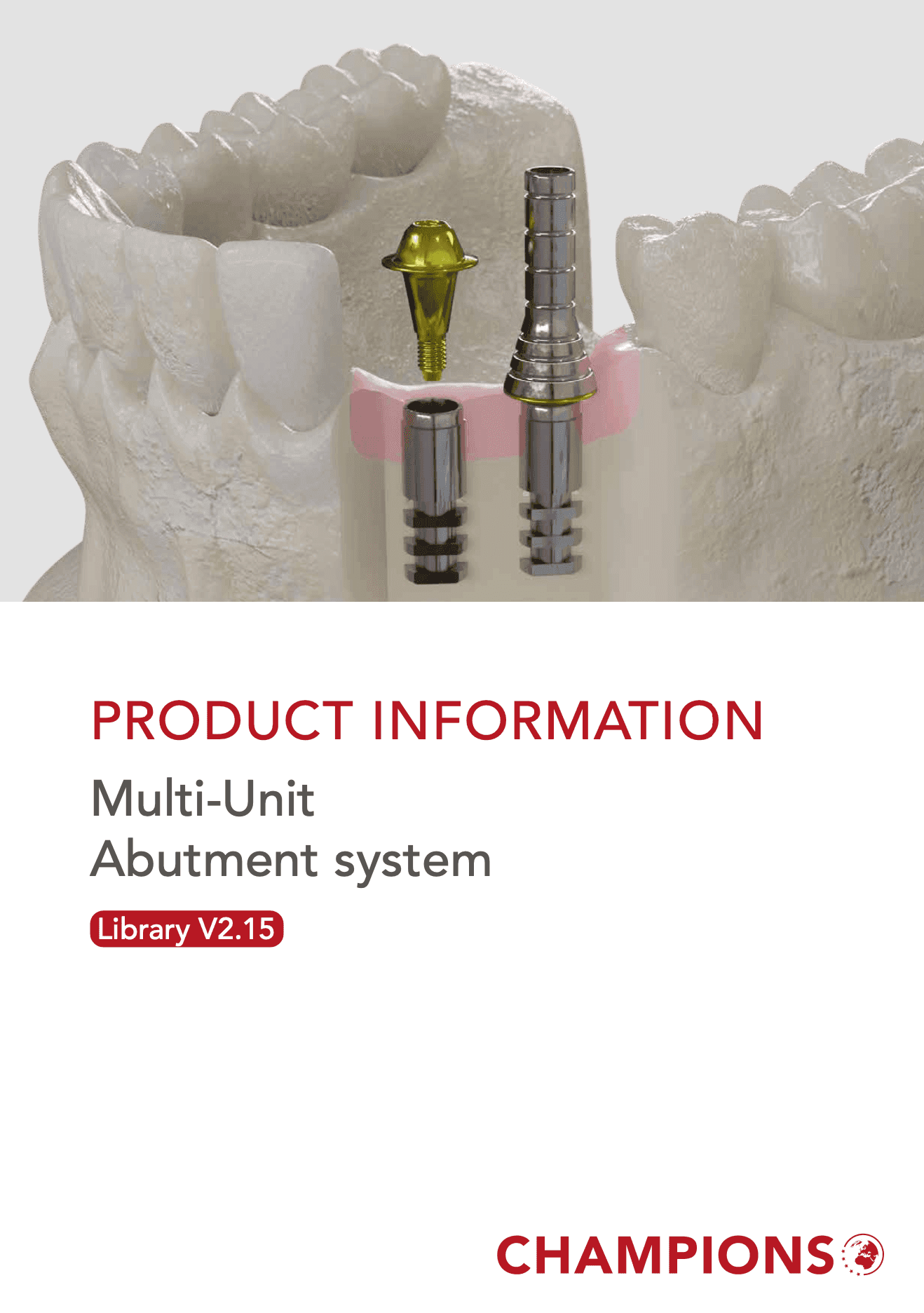Multi-Unit Abutment system V2.15