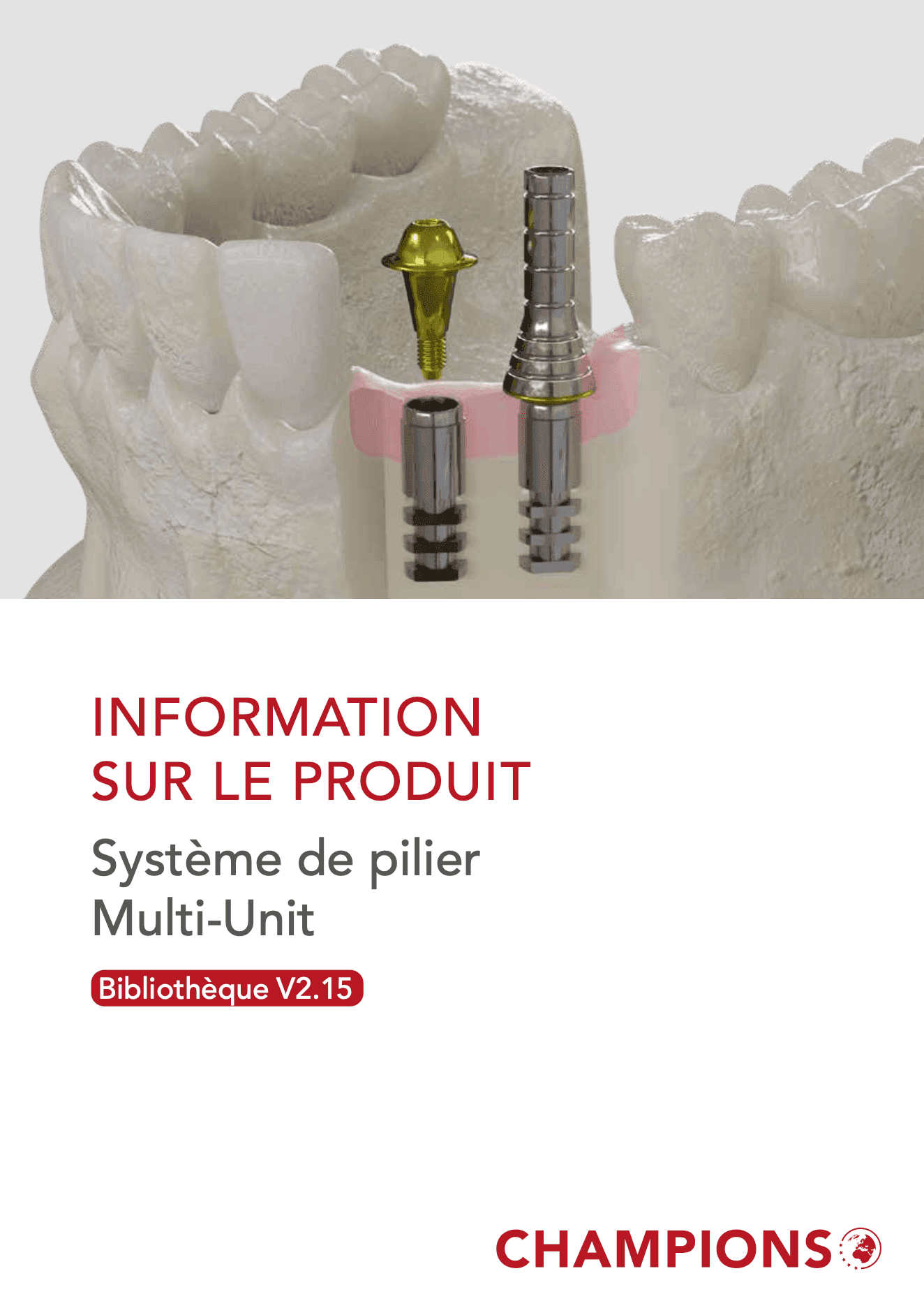 Multi-Unit Système de pilier Multi-Unit V2.15