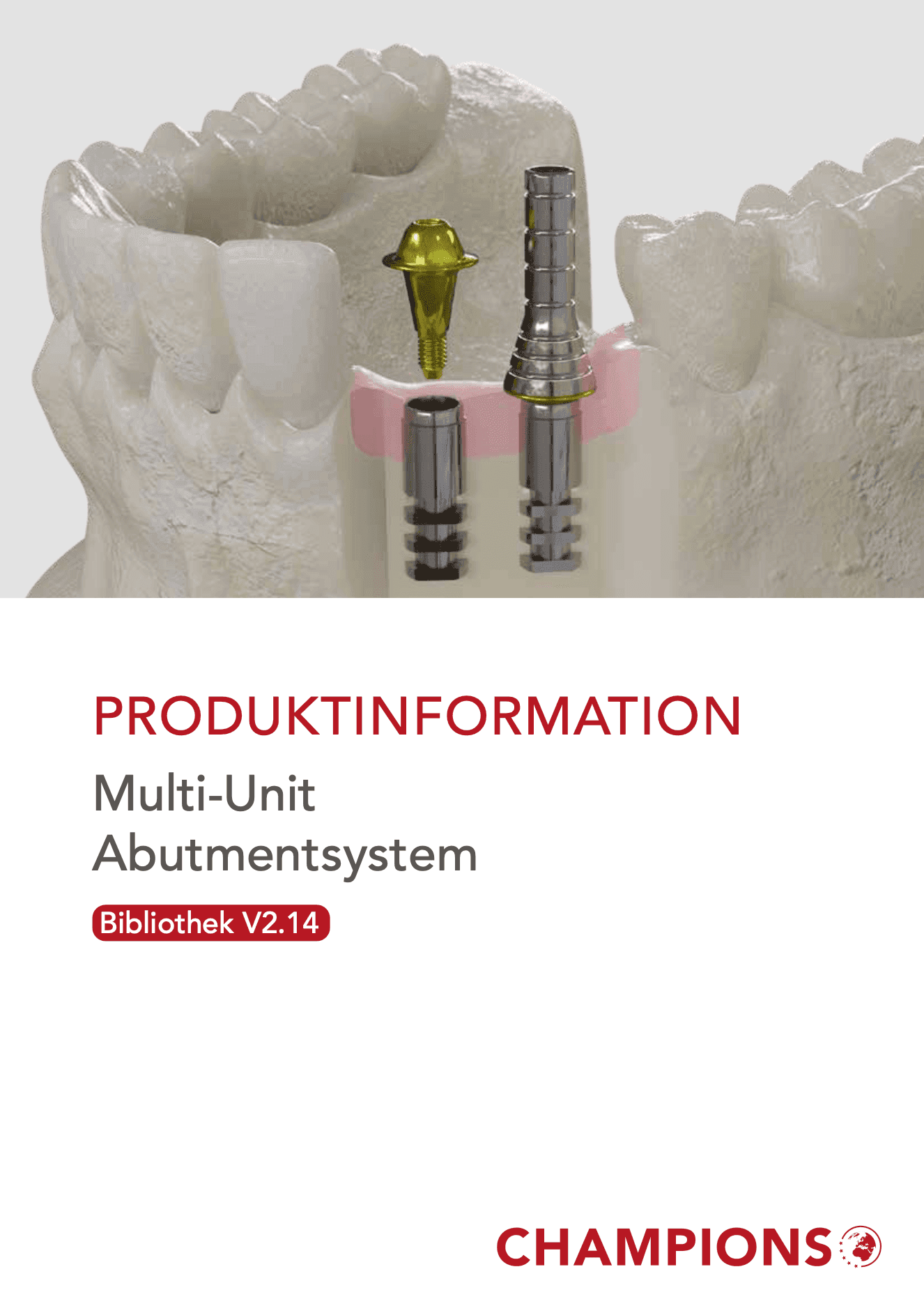 Multi-Unit Abutmentsystem V2.14