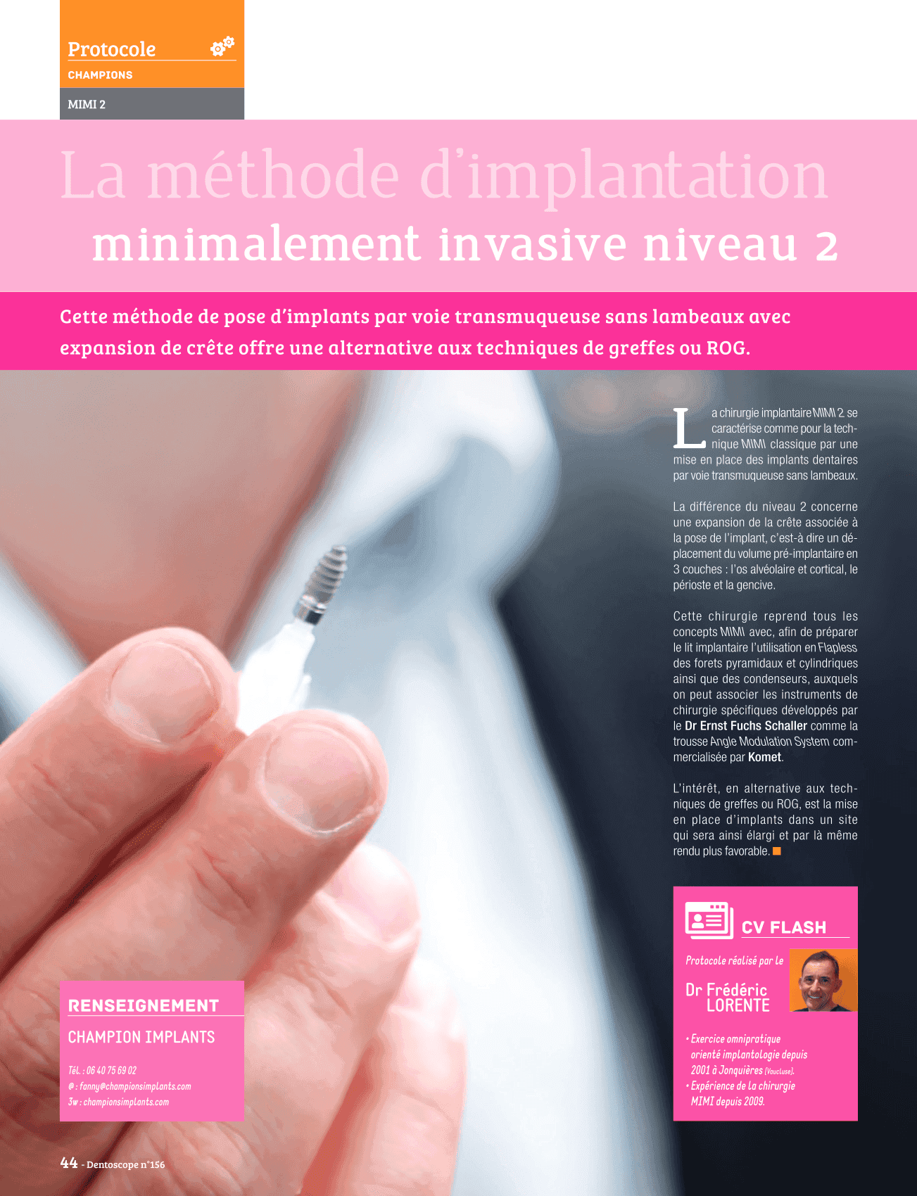 La méthode d'implantation minimalement invasive niveau 2