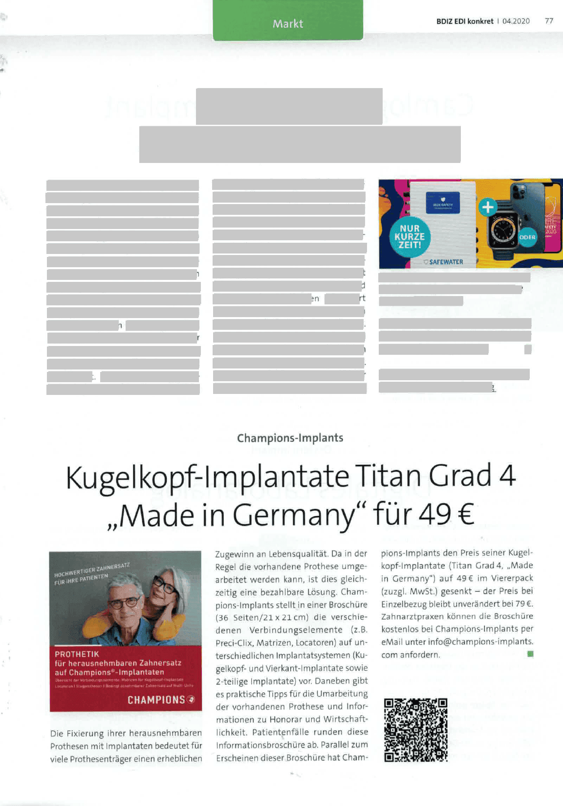 Kugelkopf-Implantate Titan Grad 4 „Made in Germany“ für 49 € im Viererpack