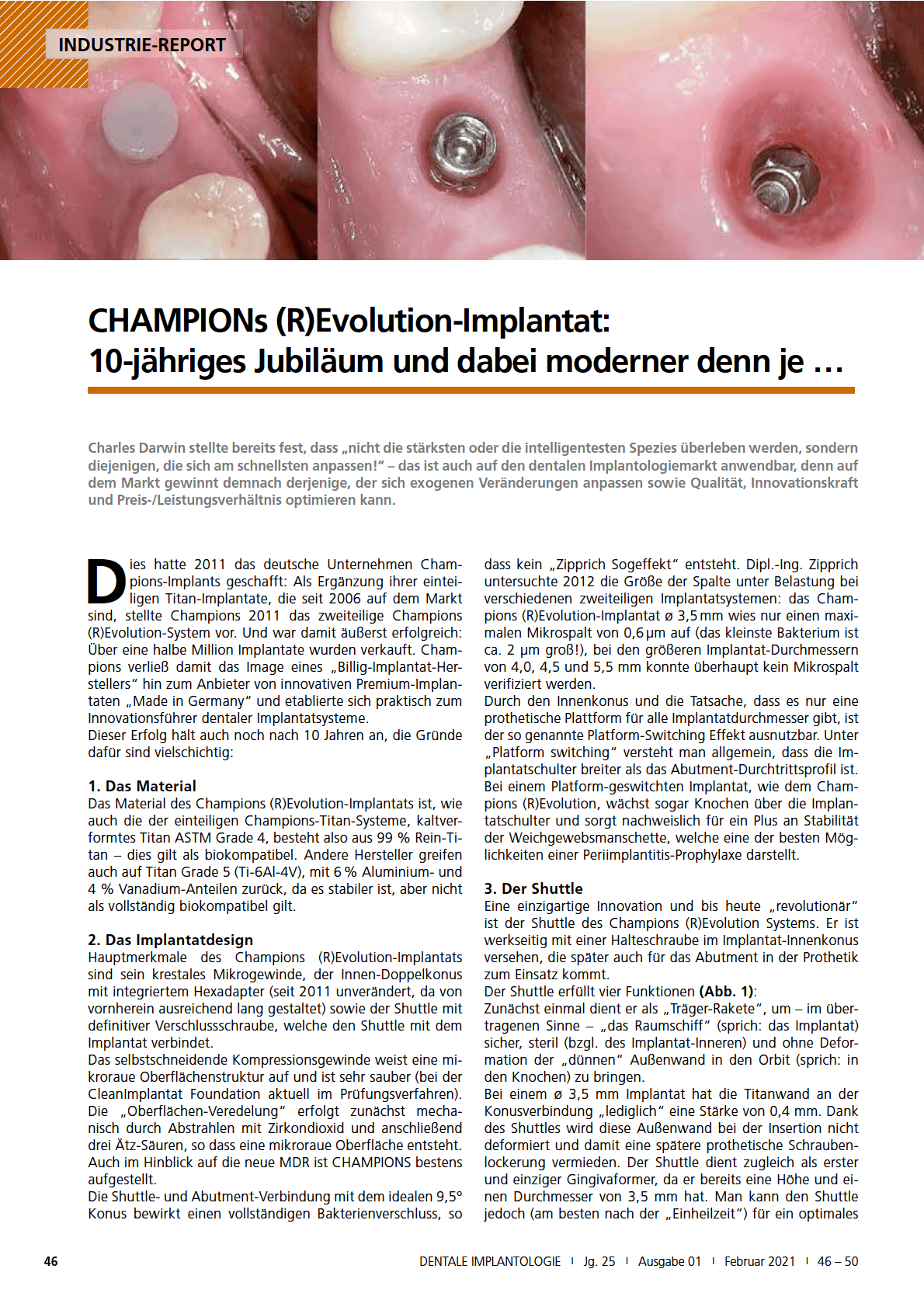 Champions (R)evolution-Implantat:
10-jähriges Jubiläum und dabei moderner denn je ...