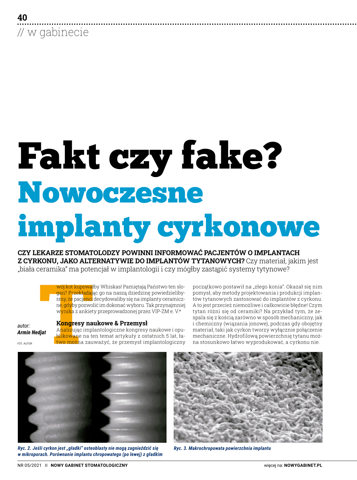Fakt czy fake? Nowoczesne implanty cyrkonowe