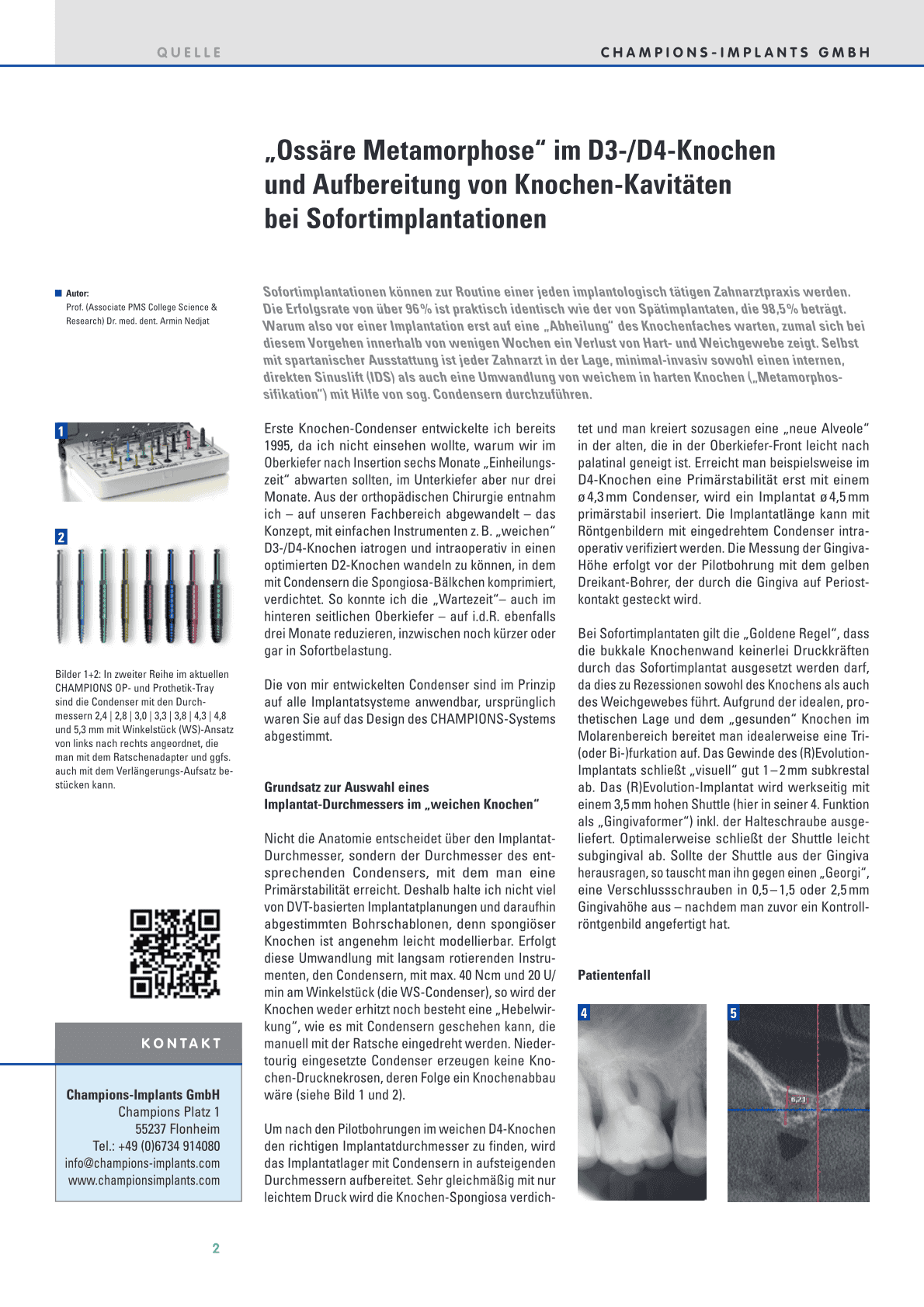„Ossäre Metamorphose“ im D3-/D4-Knochen
und Aufbereitung von Knochen-Kavitäten
bei Sofortimplantationen