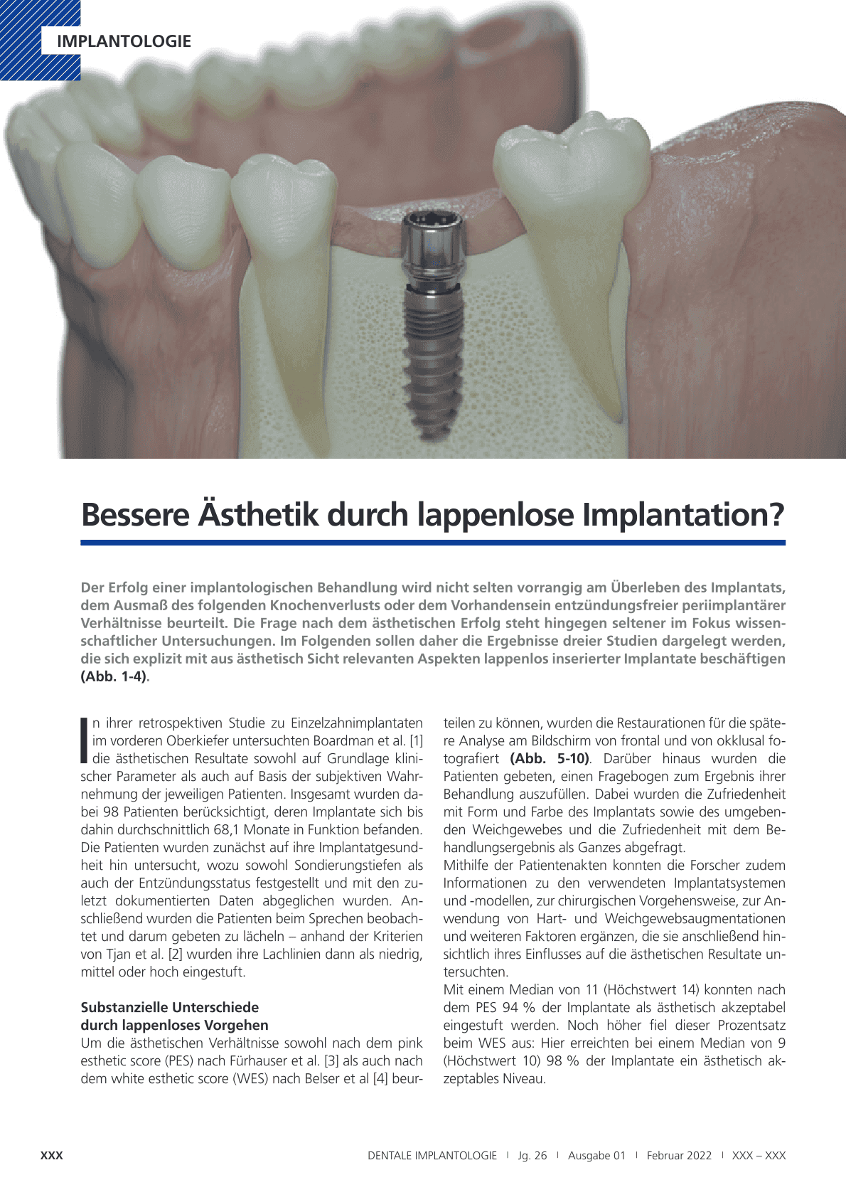 Bessere Ästhetik durch lappenlose Implantation?