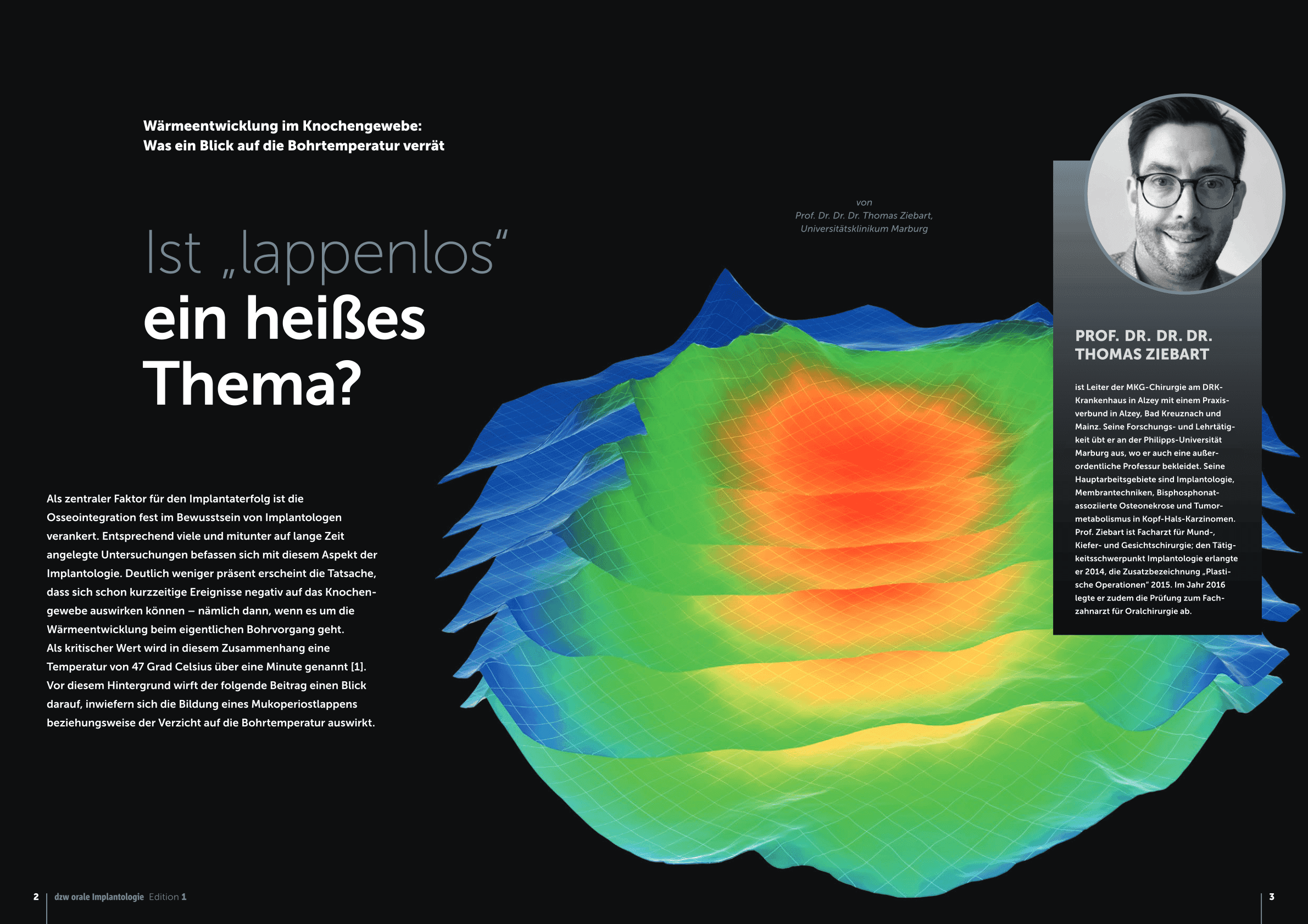 Ist „lappenlos“ ein heißes Thema?