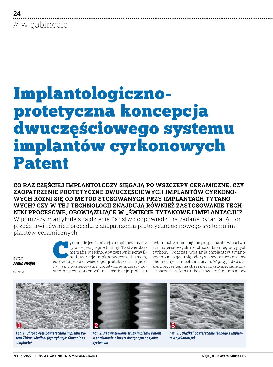 Implantologicznoprotetyczna koncepcja dwuczęściowego systemu implantów cyrkonowych Patent