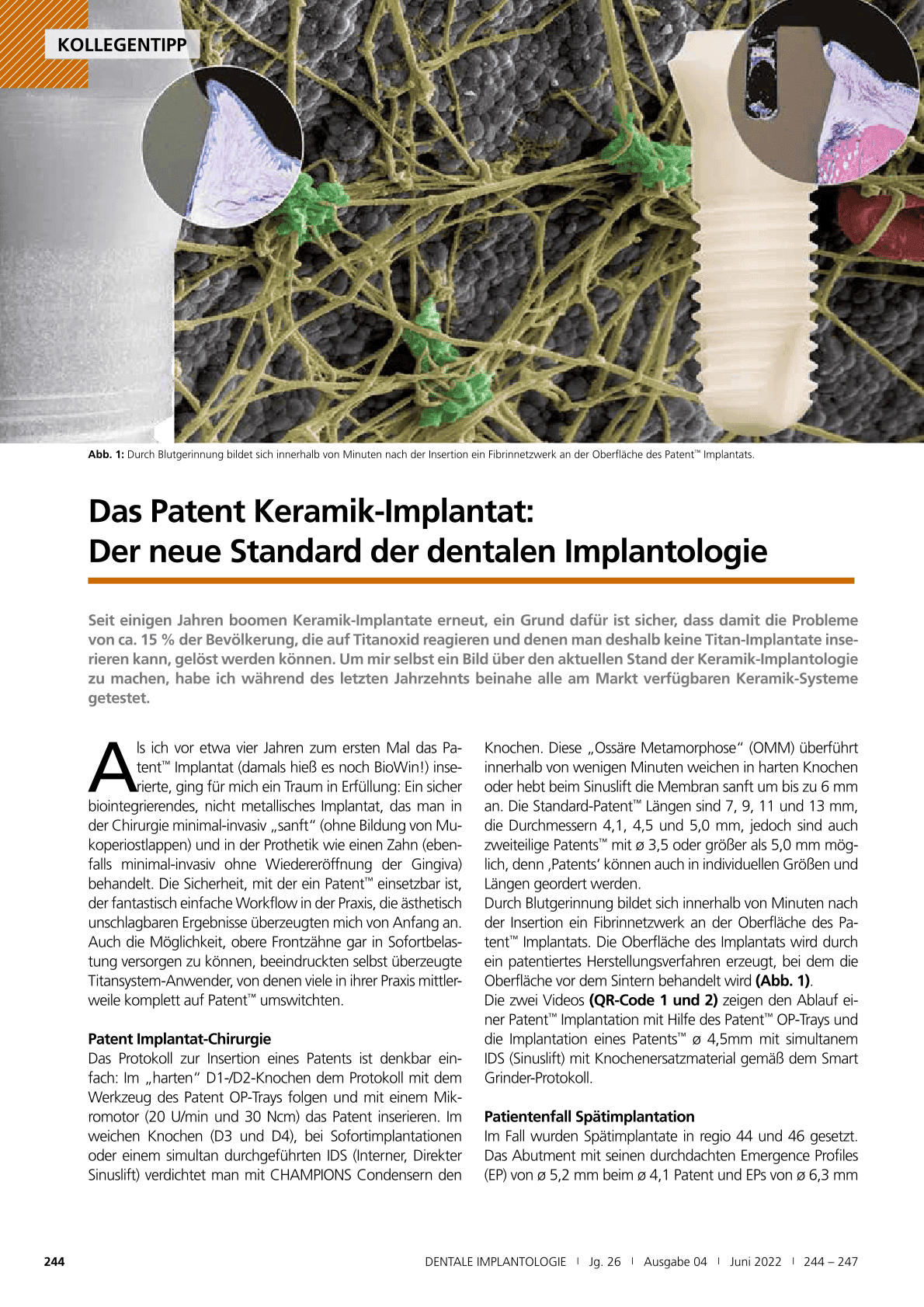 Das Patent Keramik-Implantat:
Der neue Standard der dentalen Implantologie