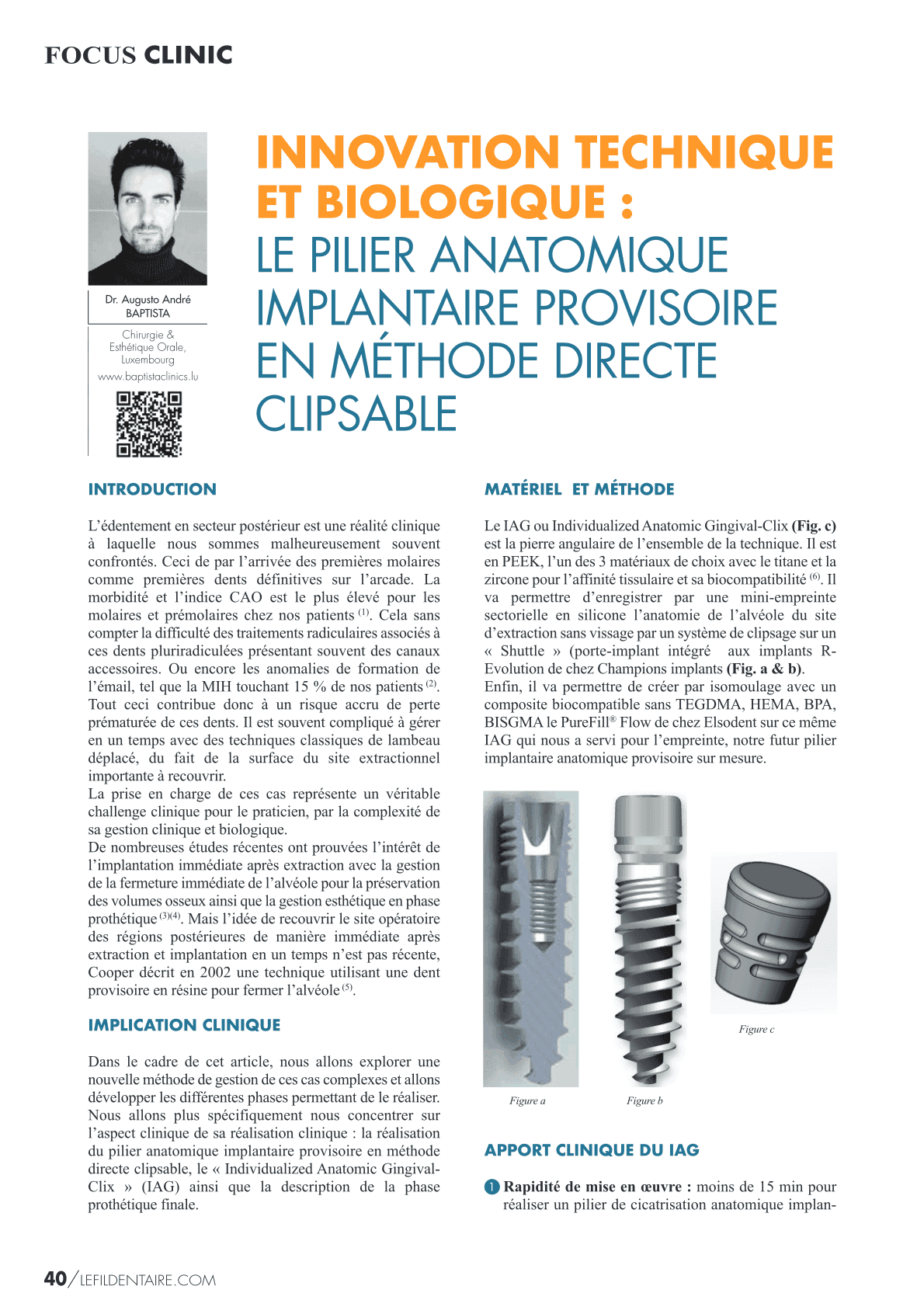 Le Pilier Anatomoque Implantaire Provisoire en Méthode directe Clipsable