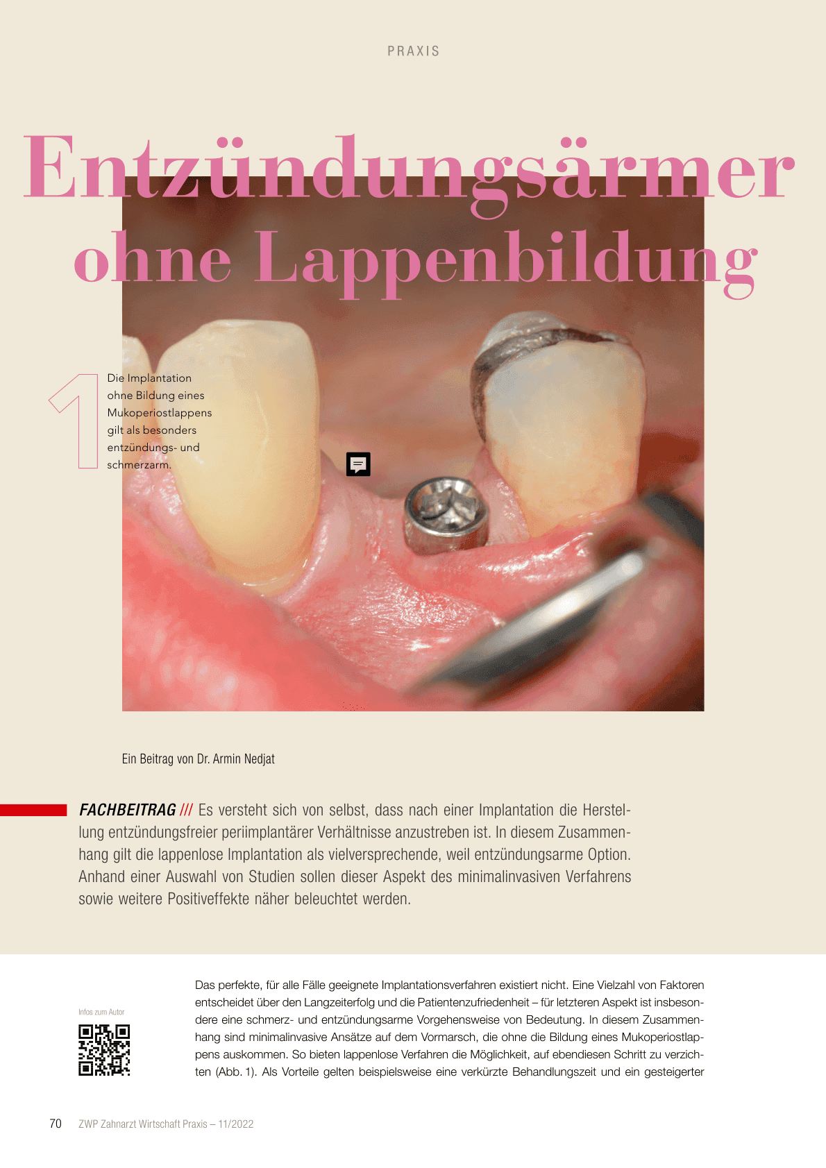 Entzündungsärmer ohne Lappenbildung