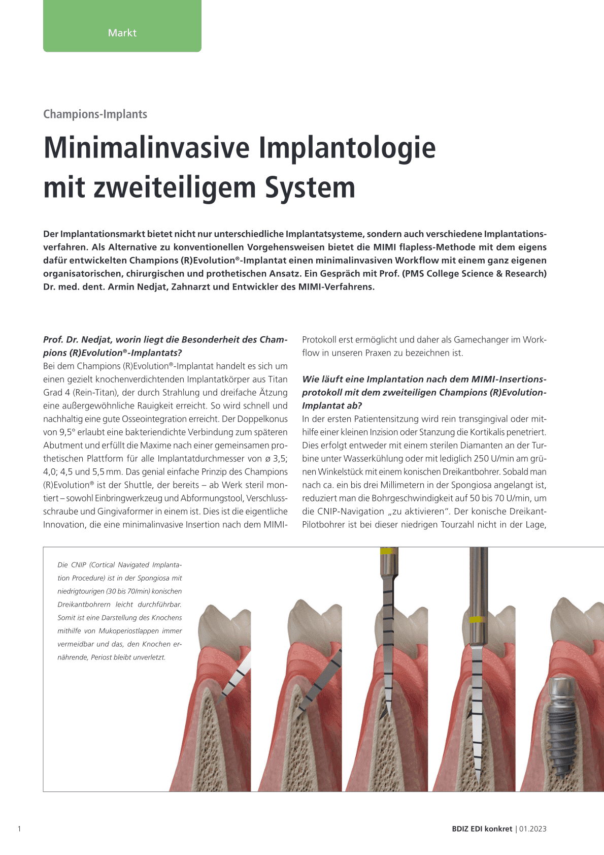 Minimalinvasive Implantologie
mit zweiteiligem System
