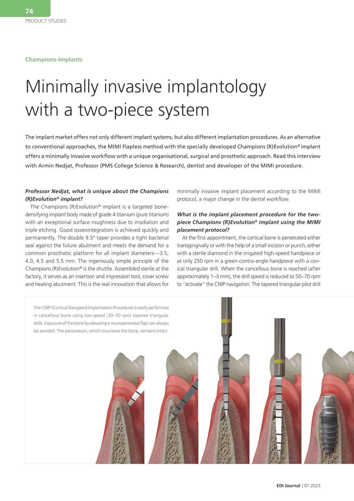 Minimally invasive implantology
with a two-piece system
