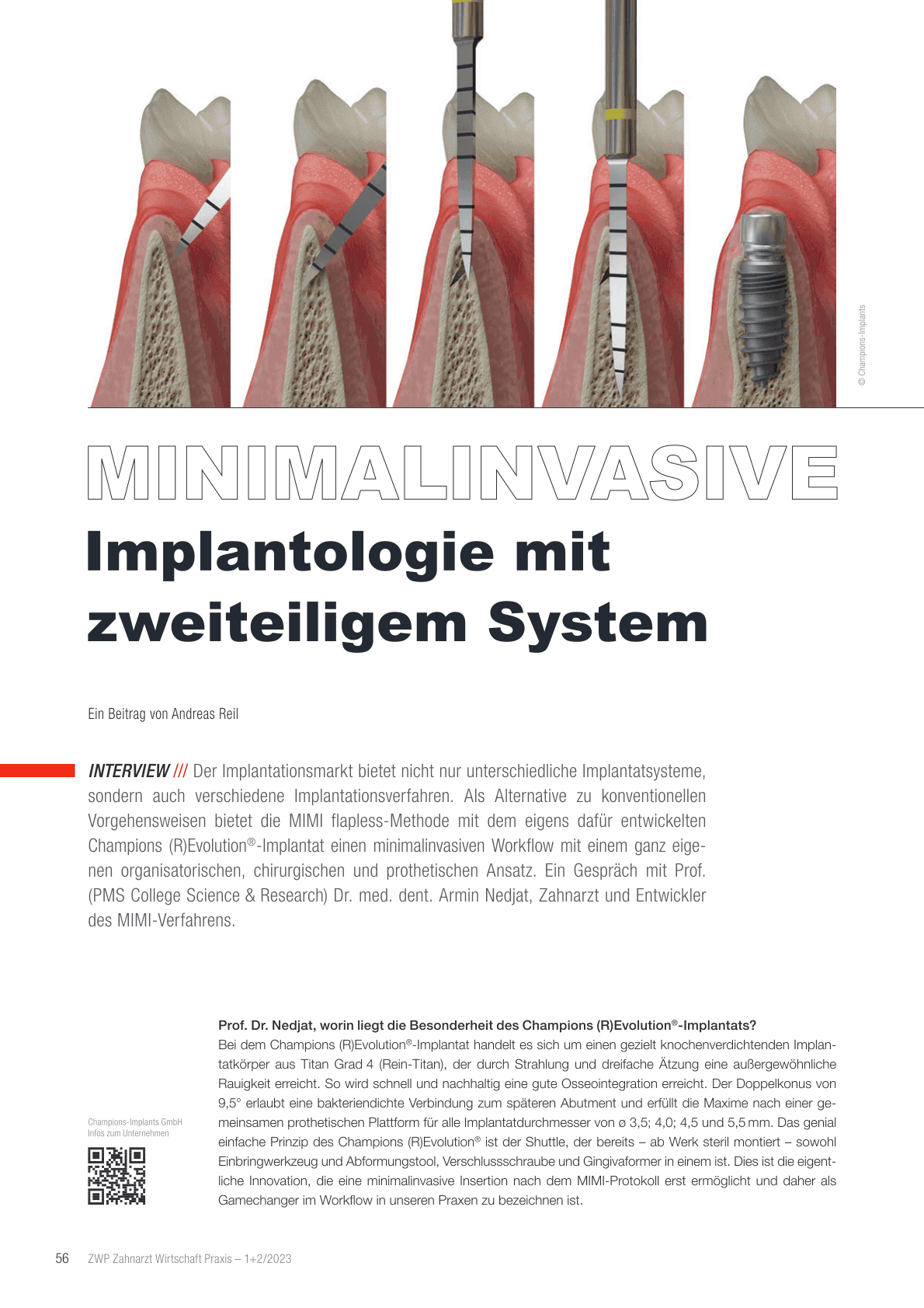 Minimalinvasive Implantologie mit zweiteiligem System