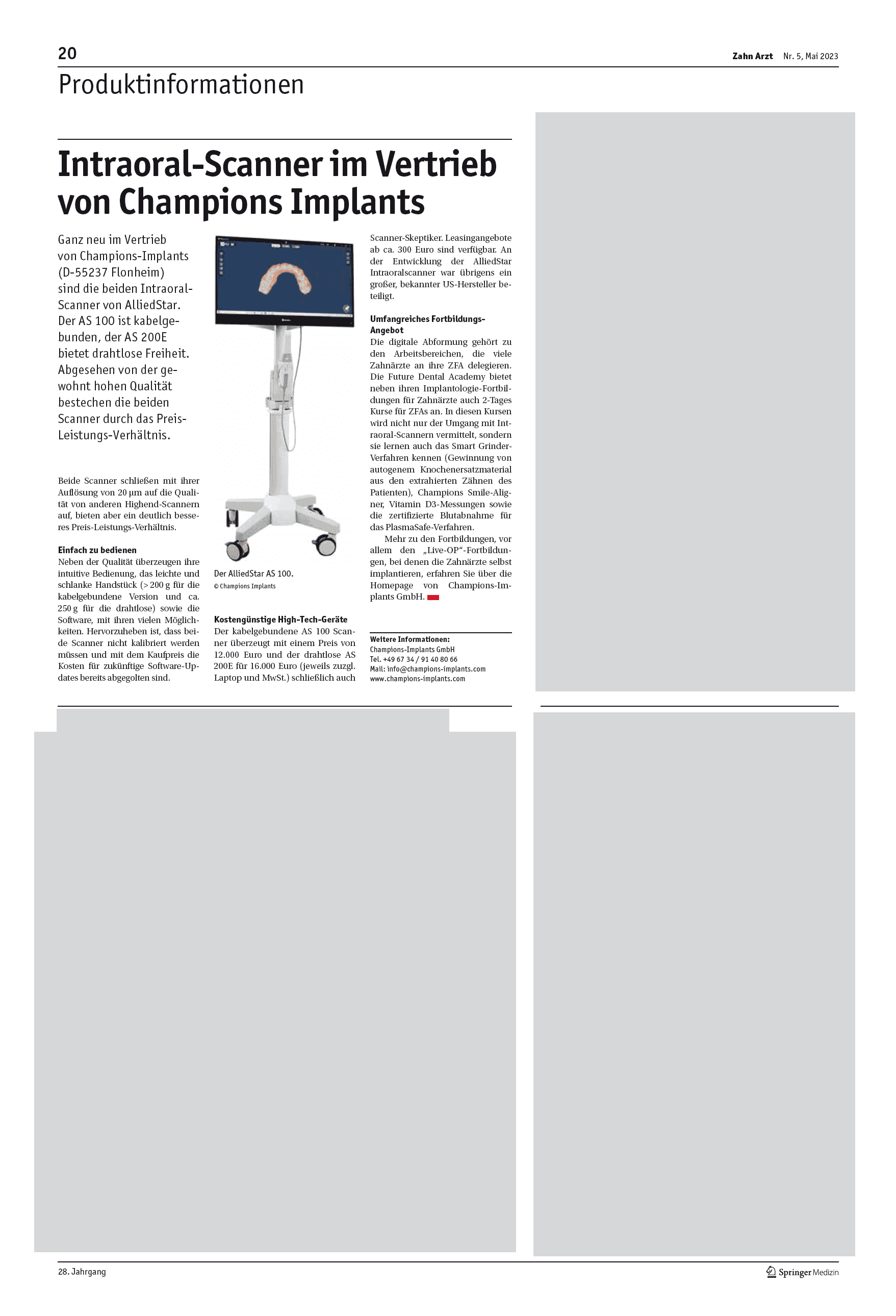 Intraoral-Scanner im Vertrieb von Champions Implants