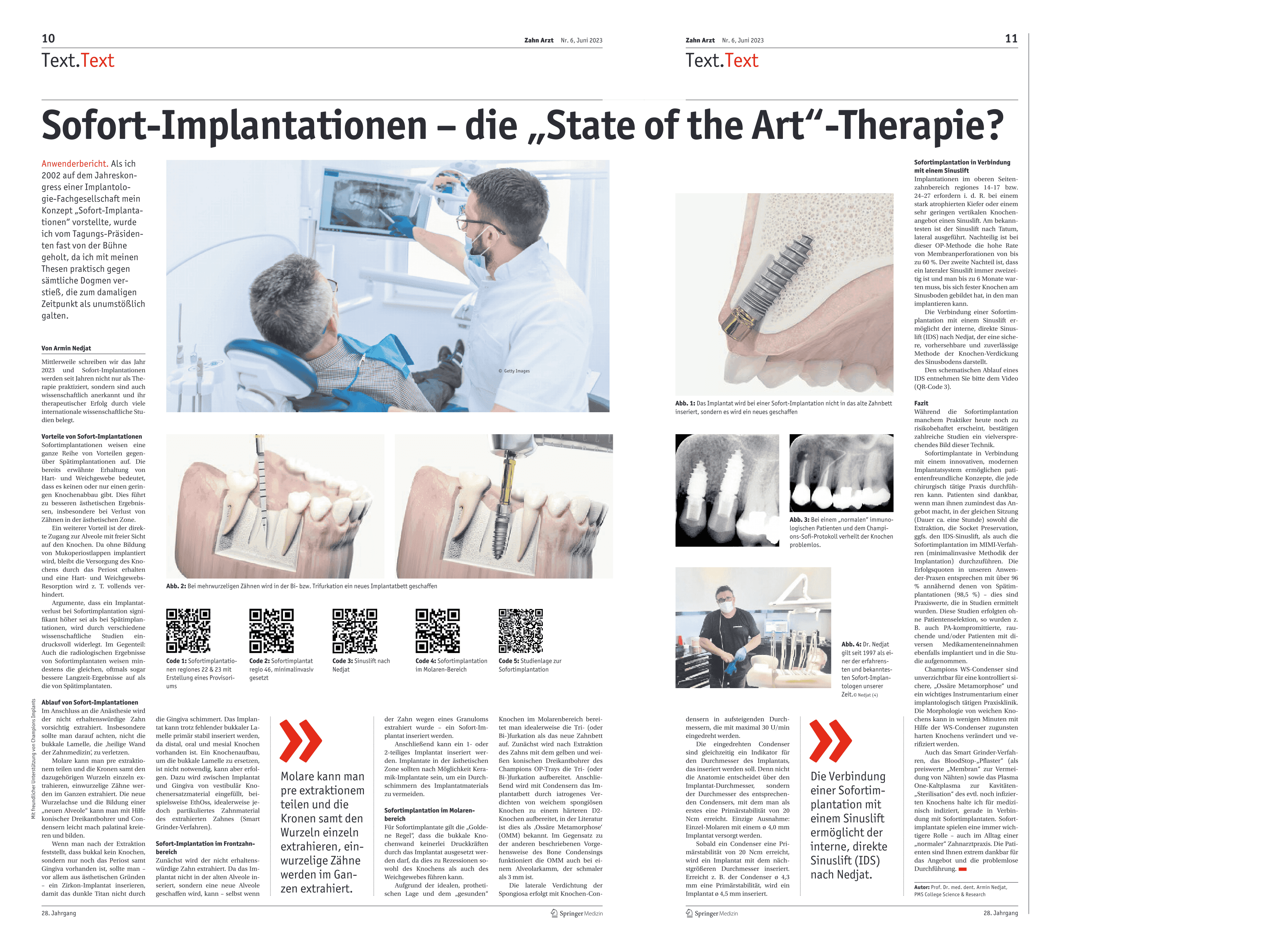 Sofort-Implantationen – die "State of the Art"-Therapie?